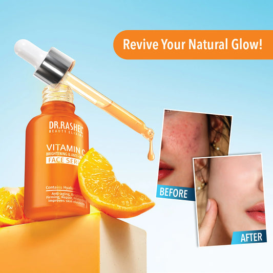Vitamin C Brightening Face Serum – Acne Removal, Dark Spots & Glowing Skin
