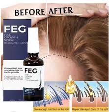FEG Hair Growth Serum – Anti Hair Fall & Fast Hair Regrowth Oil