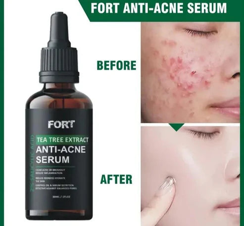 Fort Skin Clearing Serum – Acne, Pimples & Dark Spots Remover