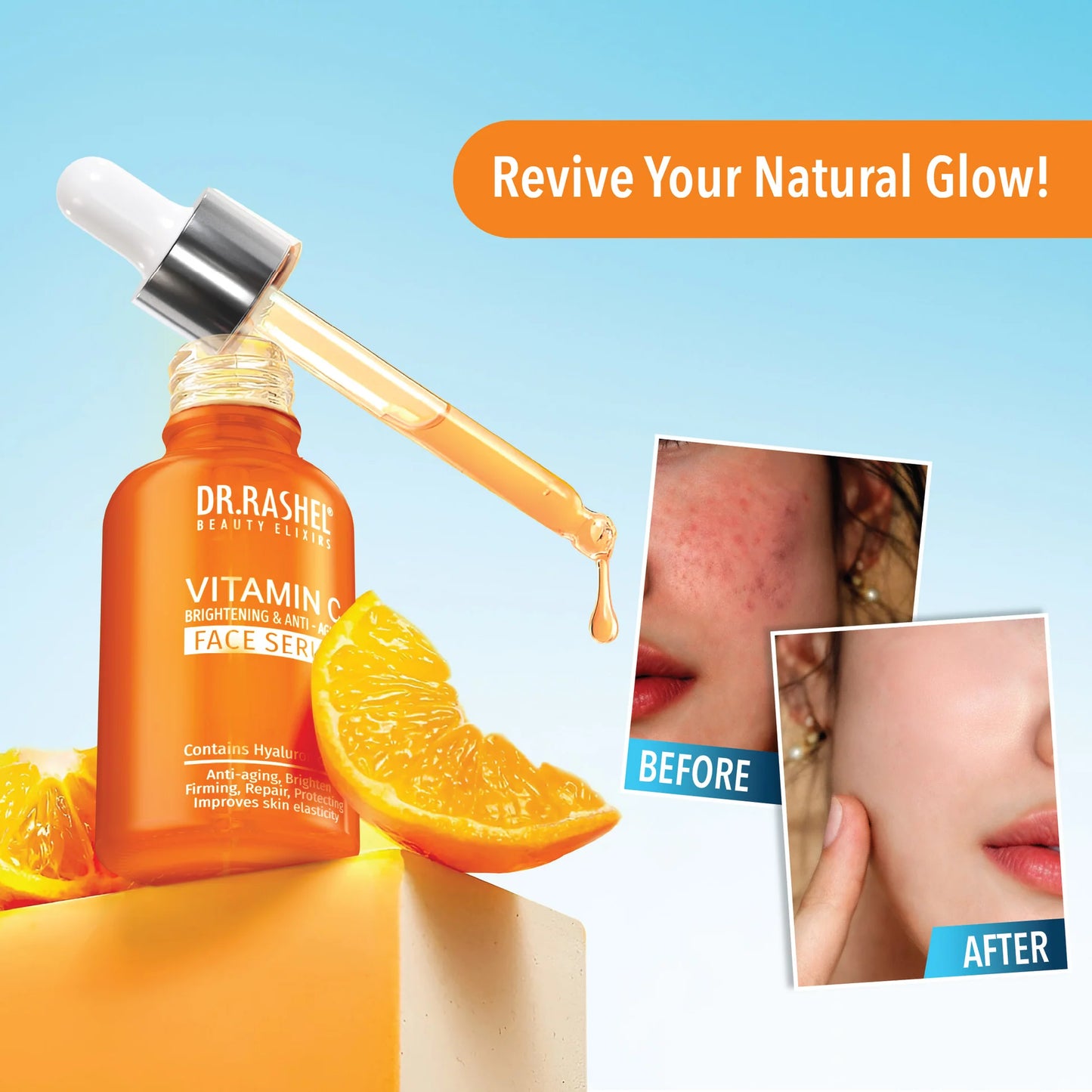 Vitamin C Brightening Face Serum – Acne Removal, Dark Spots & Glowing Skin